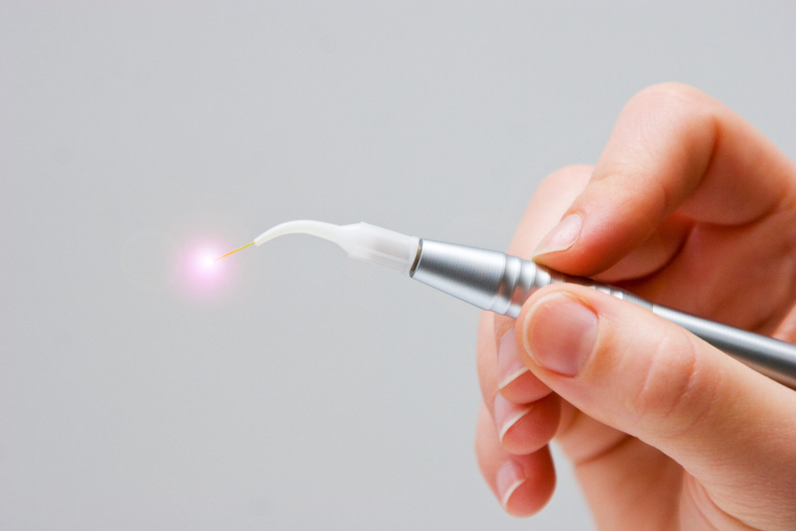 Laser Zahnbehandlung
