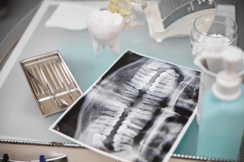 tabletop-set-up-with-dental-tools-and-props